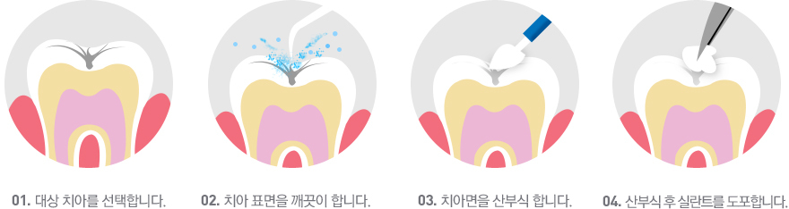 이미지명